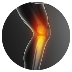 Knee Sports Injuries & Truma