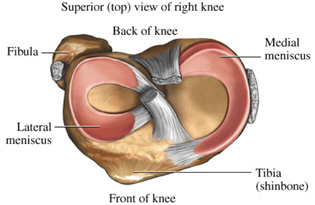 Meniscal Tears